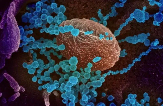 virus sars cov 2 1