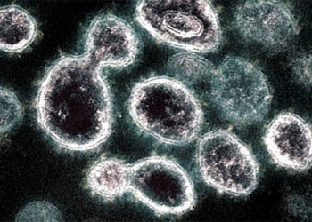 we may not just target sars cov 2 with antibodies 117835