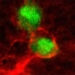 why cancer cells unexpectedly rise 117822